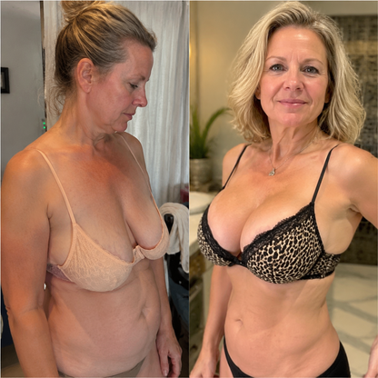 🏆 HISKIN® 👙 Breast Volume Boost & Firming Nano Microneedle Patches 🎀 Lift sagging, restore fullness—no surgery, no injections, zero irritation.