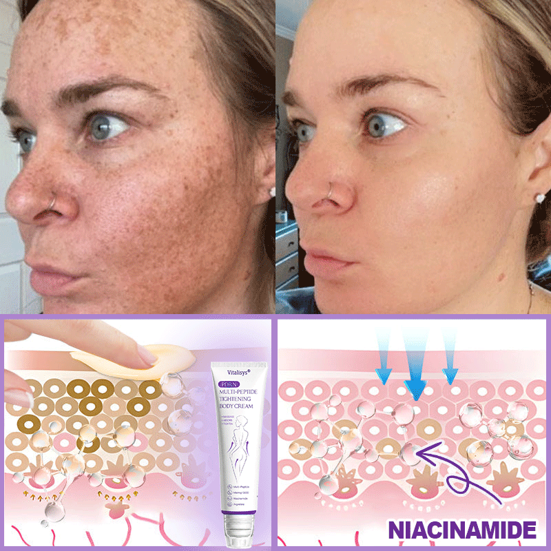 HISKIN®💟PDRN Multi-Peptide Massaging Body Roller Cream- Anti-aging, Hydrating, Skin Firming & Lifting, Skin Repair, Even Tone, Acne and Dark Spot Treatment, Wart and Mole Removal, and Psoriasis Relief