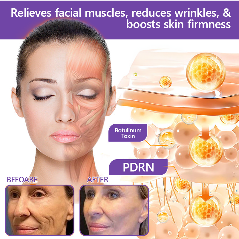 HISKIN®💟PDRN Multi-Peptide Massaging Body Roller Cream- Anti-aging, Hydrating, Skin Firming & Lifting, Skin Repair, Even Tone, Acne and Dark Spot Treatment, Wart and Mole Removal, and Psoriasis Relief