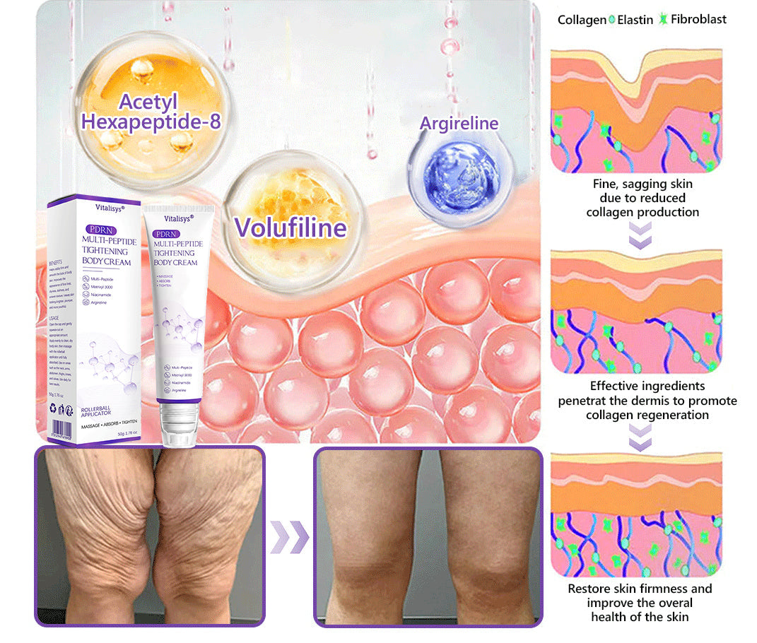 HISKIN®💟PDRN Multi-Peptide Massaging Body Roller Cream- Anti-aging, Hydrating, Skin Firming & Lifting, Skin Repair, Even Tone, Acne and Dark Spot Treatment, Wart and Mole Removal, and Psoriasis Relief