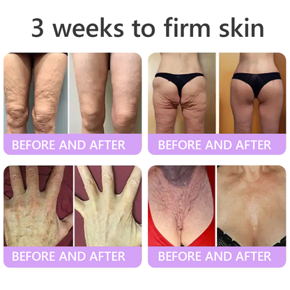 HISKIN®💟PDRN Multi-Peptide Massaging Body Roller Cream- Anti-aging, Hydrating, Skin Firming & Lifting, Skin Repair, Even Tone, Acne and Dark Spot Treatment, Wart and Mole Removal, and Psoriasis Relief