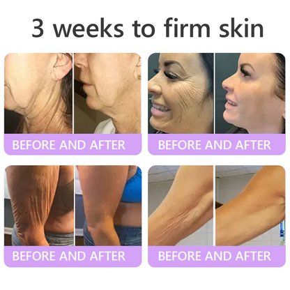 HISKIN®💟PDRN Multi-Peptide Massaging Body Roller Cream- Anti-aging, Hydrating, Skin Firming & Lifting, Skin Repair, Even Tone, Acne and Dark Spot Treatment, Wart and Mole Removal, and Psoriasis Relief