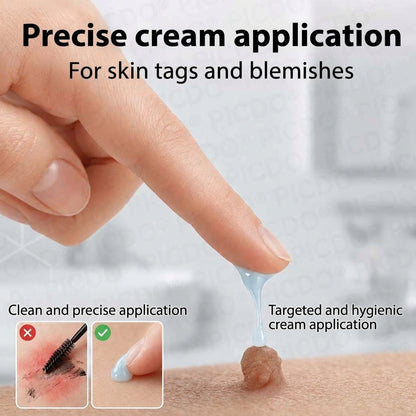 HISKIN® 10-in-1 Targeted Skin Tag & Dark Spot Cream