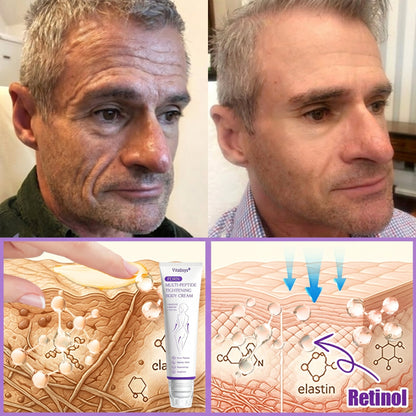 HISKIN®💟PDRN Multi-Peptide Massaging Body Roller Cream- Anti-aging, Hydrating, Skin Firming & Lifting, Skin Repair, Even Tone, Acne and Dark Spot Treatment, Wart and Mole Removal, and Psoriasis Relief