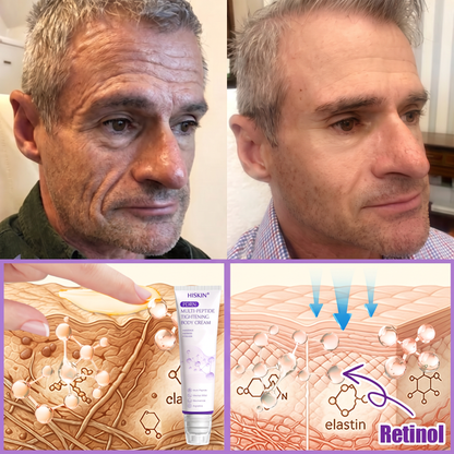 HISKIN®💟PDRN Multi-Peptide Massaging Body Roller Cream- Anti-aging, Hydrating, Skin Firming & Lifting, Skin Repair, Even Tone, Acne and Dark Spot Treatment, Wart and Mole Removal, and Psoriasis Relief
