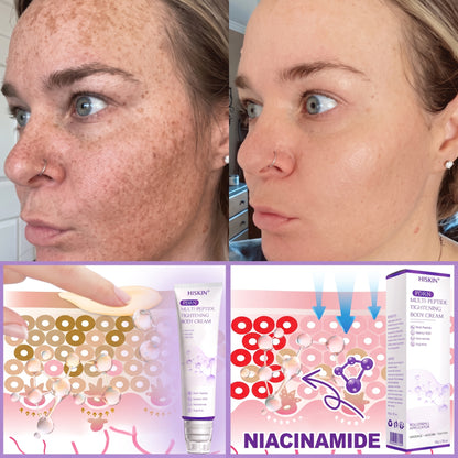 HISKIN®💟PDRN Multi-Peptide Massaging Body Roller Cream- Anti-aging, Hydrating, Skin Firming & Lifting, Skin Repair, Even Tone, Acne and Dark Spot Treatment, Wart and Mole Removal, and Psoriasis Relief